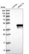 Enterotoxin type B antibody, NBP1-82059, Novus Biologicals, Western Blot image 
