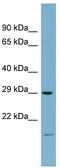 COP9 Signalosome Subunit 7A antibody, TA345035, Origene, Western Blot image 