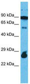 Rap Guanine Nucleotide Exchange Factor Like 1 antibody, TA331916, Origene, Western Blot image 