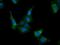 Caseinolytic Mitochondrial Matrix Peptidase Proteolytic Subunit antibody, MA5-25329, Invitrogen Antibodies, Immunocytochemistry image 