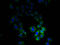 Cation-dependent mannose-6-phosphate receptor antibody, A53316-100, Epigentek, Immunofluorescence image 