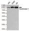 HK II antibody, MBS475044, MyBioSource, Western Blot image 