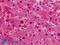 Lactate Dehydrogenase A antibody, LS-B8758, Lifespan Biosciences, Immunohistochemistry paraffin image 