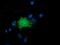 LRAT Domain Containing 2 antibody, MA5-25289, Invitrogen Antibodies, Immunocytochemistry image 