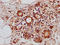 Zinc Finger Protein 3 antibody, LS-C681743, Lifespan Biosciences, Immunohistochemistry paraffin image 