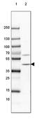 Phytanoyl-CoA dioxygenase, peroxisomal antibody, NBP1-87349, Novus Biologicals, Western Blot image 