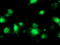 Bifunctional coenzyme A synthase antibody, TA503344, Origene, Immunofluorescence image 
