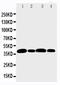 Aurora Kinase B antibody, PA1806, Boster Biological Technology, Western Blot image 