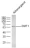 Solute Carrier Family 11 Member 2 antibody, orb5976, Biorbyt, Western Blot image 