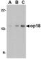 OP18 antibody, MBS150543, MyBioSource, Western Blot image 