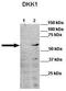 Dickkopf WNT Signaling Pathway Inhibitor 1 antibody, TA346496, Origene, Western Blot image 