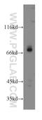 G Protein Nucleolar 1 (Putative) antibody, 14078-1-AP, Proteintech Group, Western Blot image 