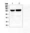 Collagen Type II Alpha 1 Chain antibody, A00517-1, Boster Biological Technology, Western Blot image 