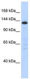 Splicing Factor 3b Subunit 3 antibody, TA343785, Origene, Western Blot image 