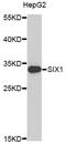 Homeobox protein SIX1 antibody, STJ111366, St John