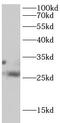 TNFRSF1A Associated Via Death Domain antibody, FNab10260, FineTest, Western Blot image 