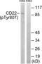 CD22 Molecule antibody, TA313577, Origene, Western Blot image 