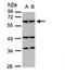 Coronin 1A antibody, PA5-28450, Invitrogen Antibodies, Western Blot image 