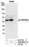 Pre-MRNA Processing Factor 38A antibody, A304-635A, Bethyl Labs, Immunoprecipitation image 