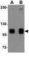 Autophagy Related 9B antibody, GTX85184, GeneTex, Western Blot image 