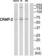 Dihydropyrimidinase Like 2 antibody, TA313765, Origene, Western Blot image 