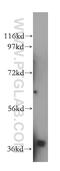 N-Acetylglucosamine Kinase antibody, 15051-1-AP, Proteintech Group, Western Blot image 