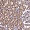 Solute Carrier Family 35 Member D2 antibody, HPA064047, Atlas Antibodies, Immunohistochemistry paraffin image 