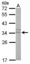 Phospholipid Scramblase 3 antibody, NBP1-33072, Novus Biologicals, Western Blot image 