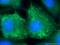 HMW Cytokeratin antibody, 10164-2-AP, Proteintech Group, Immunofluorescence image 