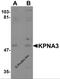 Importin subunit alpha-3 antibody, 5985, ProSci Inc, Western Blot image 