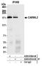 Capping Protein Regulator And Myosin 1 Linker 2 antibody, A305-831A-M, Bethyl Labs, Immunoprecipitation image 