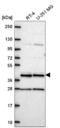 Coiled-Coil Domain Containing 84 antibody, NBP2-57702, Novus Biologicals, Western Blot image 