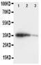 Eukaryotic translation initiation factor 2-alpha kinase 4 antibody, PA2027, Boster Biological Technology, Western Blot image 