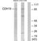 Cadherin 19 antibody, A11507, Boster Biological Technology, Western Blot image 