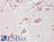  antibody, LS-B13640, Lifespan Biosciences, Immunohistochemistry paraffin image 