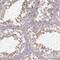 Family With Sequence Similarity 13 Member B antibody, PA5-67216, Invitrogen Antibodies, Immunohistochemistry paraffin image 