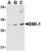 BMI1 Proto-Oncogene, Polycomb Ring Finger antibody, TA306298, Origene, Western Blot image 
