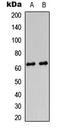 Protein Kinase AMP-Activated Non-Catalytic Subunit Gamma 2 antibody, LS-C358248, Lifespan Biosciences, Western Blot image 