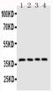 Antigen-presenting glycoprotein CD1d antibody, PA5-78964, Invitrogen Antibodies, Western Blot image 