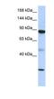 Putative ATP-dependent RNA helicase TDRD9 antibody, NBP1-57116, Novus Biologicals, Western Blot image 