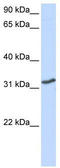 Homeobox protein DLX-3 antibody, TA329350, Origene, Western Blot image 