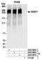 Ribosome Binding Protein 1 antibody, A303-996A, Bethyl Labs, Immunoprecipitation image 
