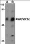 Activin A Receptor Type 1 antibody, orb88684, Biorbyt, Western Blot image 