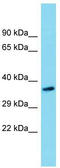 Sideroflexin 5 antibody, TA334376, Origene, Western Blot image 