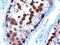 T-Complex 1 antibody, NB100-1400, Novus Biologicals, Immunohistochemistry paraffin image 