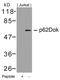 Docking protein 1 antibody, 79-392, ProSci, Western Blot image 