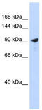 Pappalysin-2 antibody, TA344169, Origene, Western Blot image 