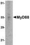 MYD88 Innate Immune Signal Transduction Adaptor antibody, TA319687, Origene, Western Blot image 