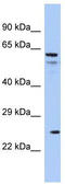Aquaporin 5 antibody, TA335862, Origene, Western Blot image 