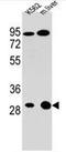 Electron transfer flavoprotein subunit alpha, mitochondrial antibody, AP51468PU-N, Origene, Western Blot image 